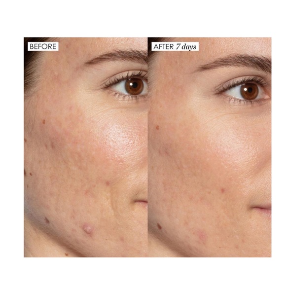 🆕 Sunday Riley Good Genes - Picture 3 of 4